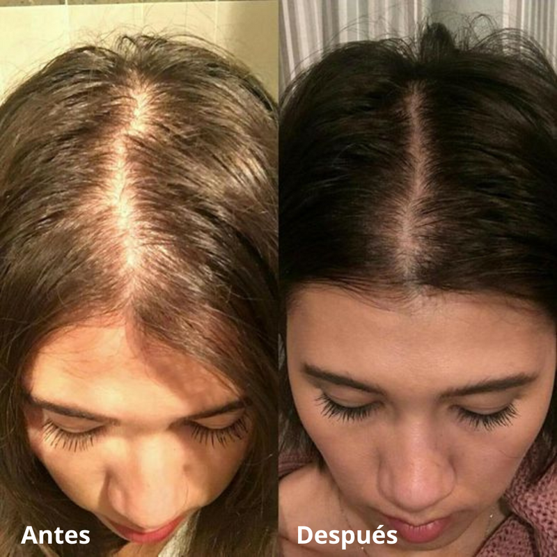 Thera™ Cepillo Terapéutico Para el Crecimiento del Cabello